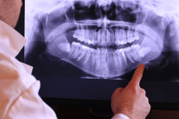 Best Broken or Cracked Tooth Emergency Dentist in Helmetta, NJ
