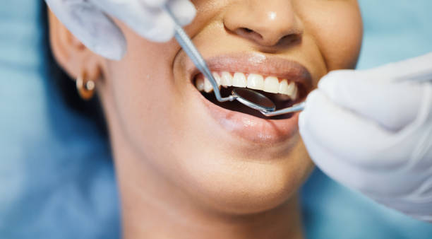 Best Emergency Root Canal Treatment in Helmetta, NJ