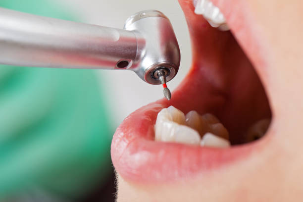 Best Weekend Emergency Dentist in Helmetta, NJ